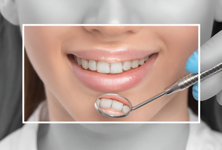 How Cosmetic Dentistry Can Transform Your Smile